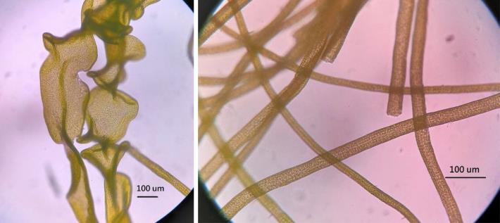 圖4、（左）具較長的分枝且有明顯彎曲皺褶；（右）分枝無明顯的彎曲皺褶，兩者都屬於石蓴屬管狀型藻類