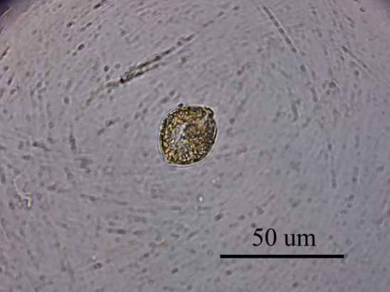 顯微鏡下的甲藻形態