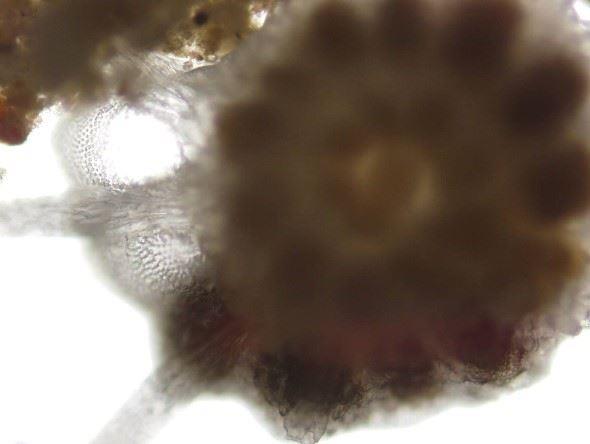 圖3、有些有孔蟲殼體表面具有瘤狀殼飾